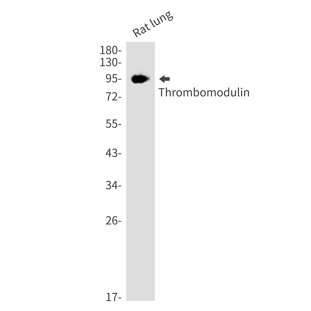 Thrombomodulin Rabbit Monoclonal Antibody