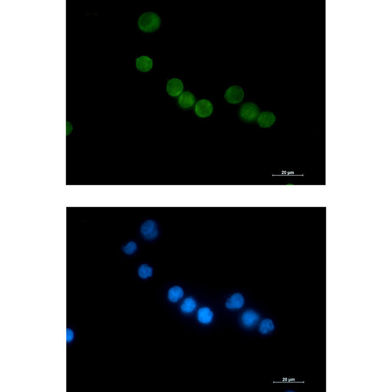 Thymidylate Synthase Rabbit Monoclonal Antibody