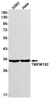 Transmembrane Protein 192 Rabbit Monoclonal Antibody