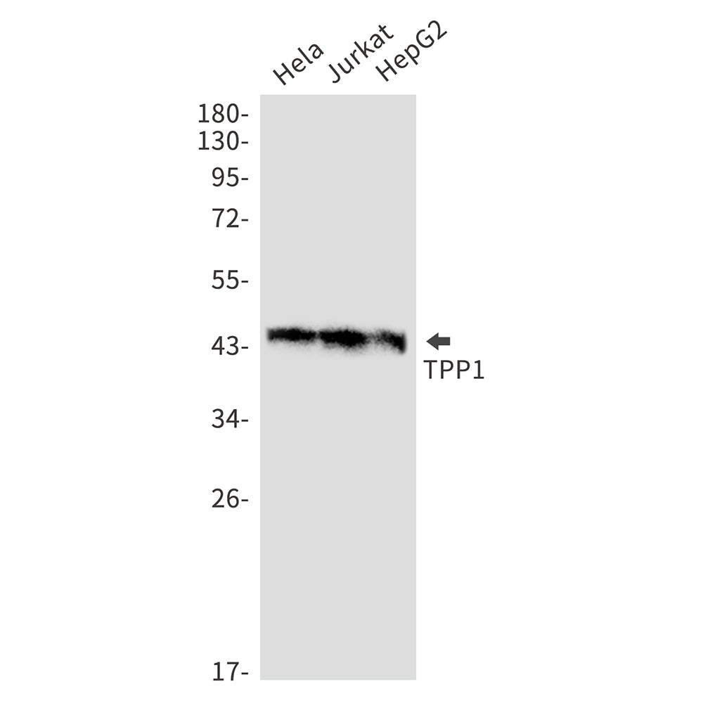 TPP1 Rabbit Monoclonal Antibody