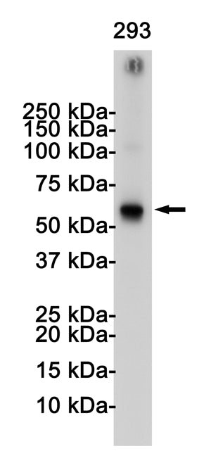TRAF6 Rabbit Monoclonal Antibody