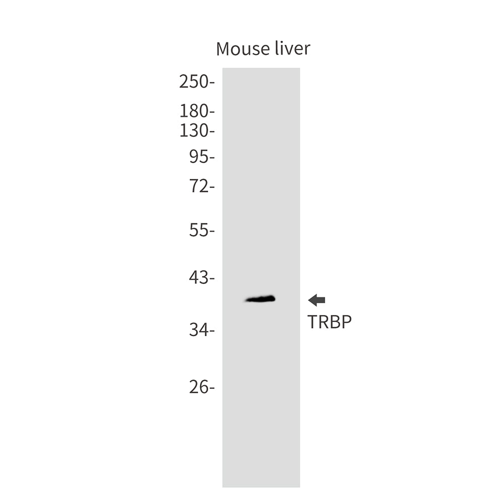 TARBP2 Rabbit Monoclonal Antibody