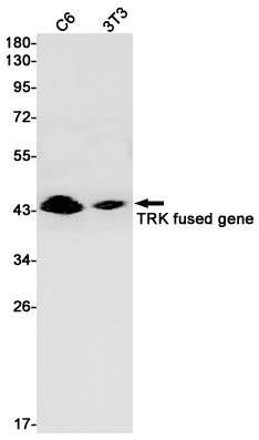 TFG Rabbit Monoclonal Antibody