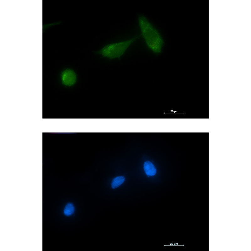 TSG101 Rabbit Monoclonal Antibody