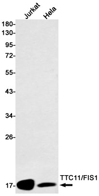 Mitochondrial Fission 1 Protein Rabbit Monoclonal Antibody