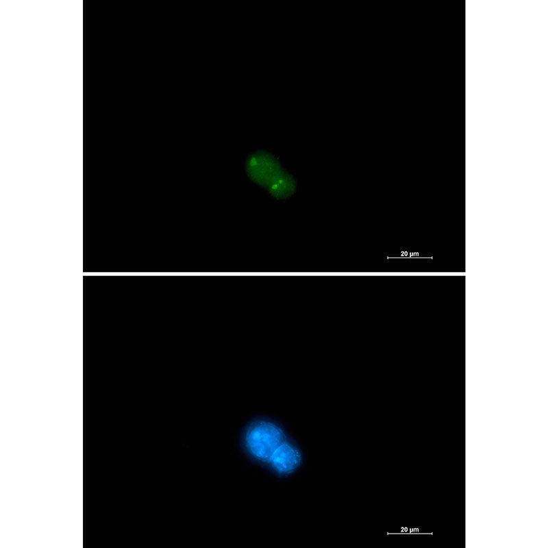 UBA2 Rabbit Monoclonal Antibody
