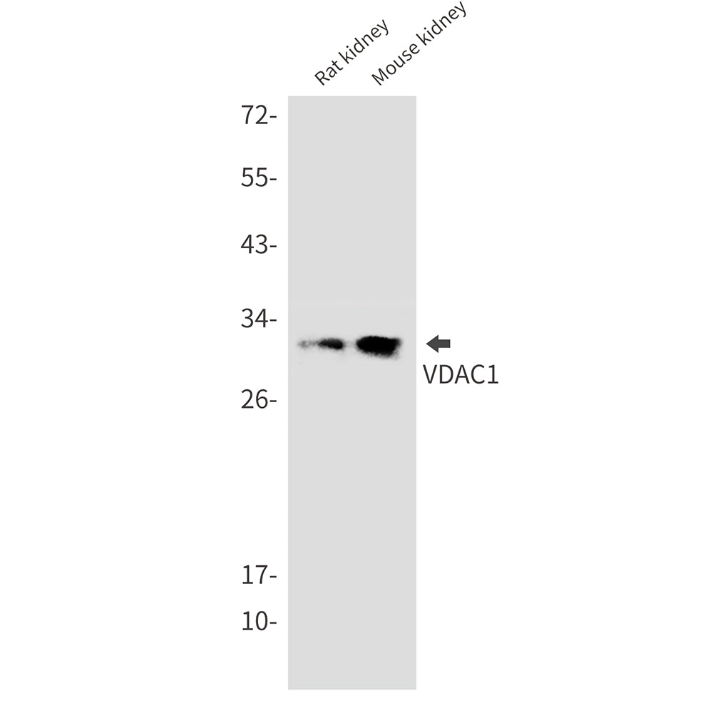 VDAC1 Rabbit Monoclonal Antibody