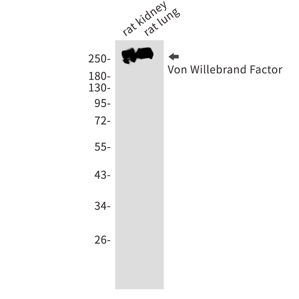 von Willebrand Factor Rabbit Monoclonal Antibody