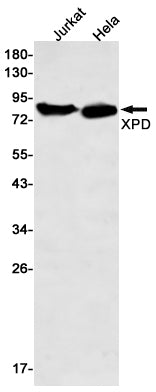 XPD Rabbit Monoclonal Antibody