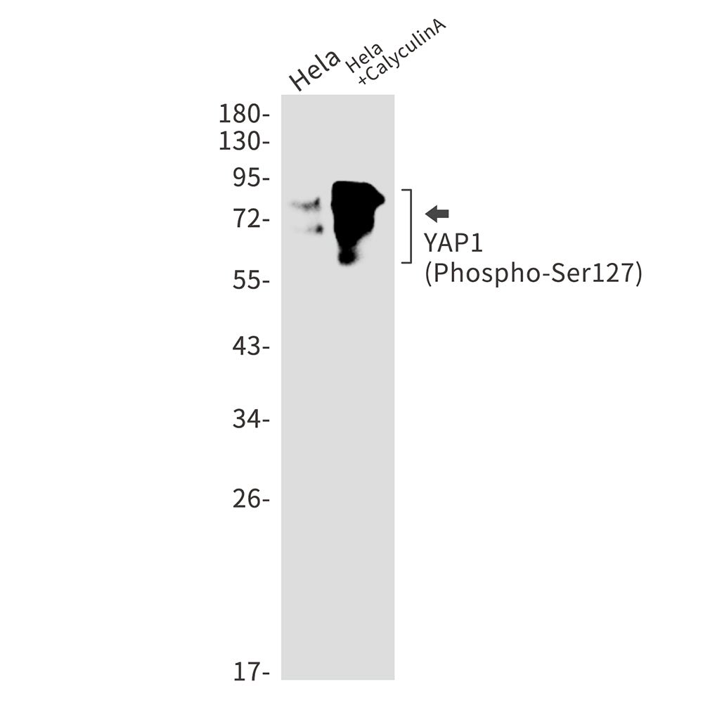 Phospho-YAP1 (Ser127) Rabbit Monoclonal Antibody