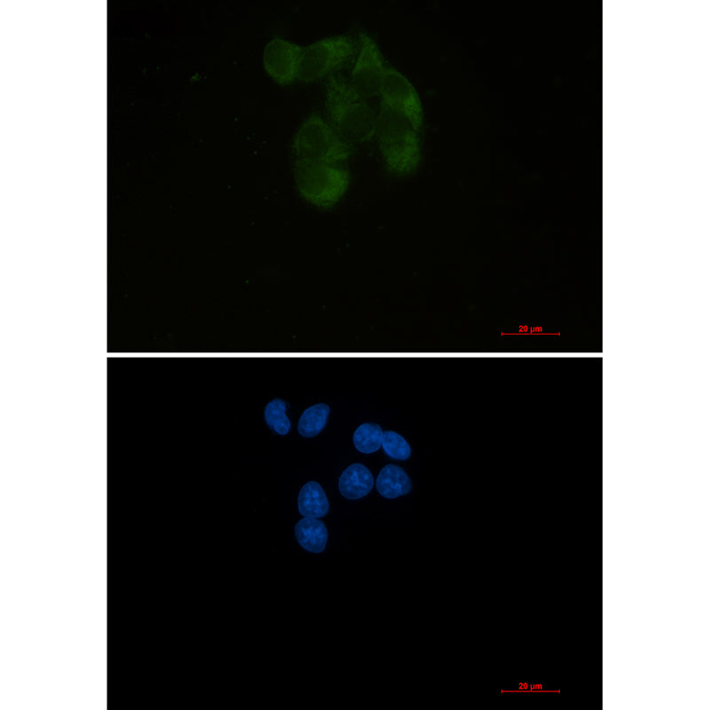 YB1 Rabbit Monoclonal Antibody