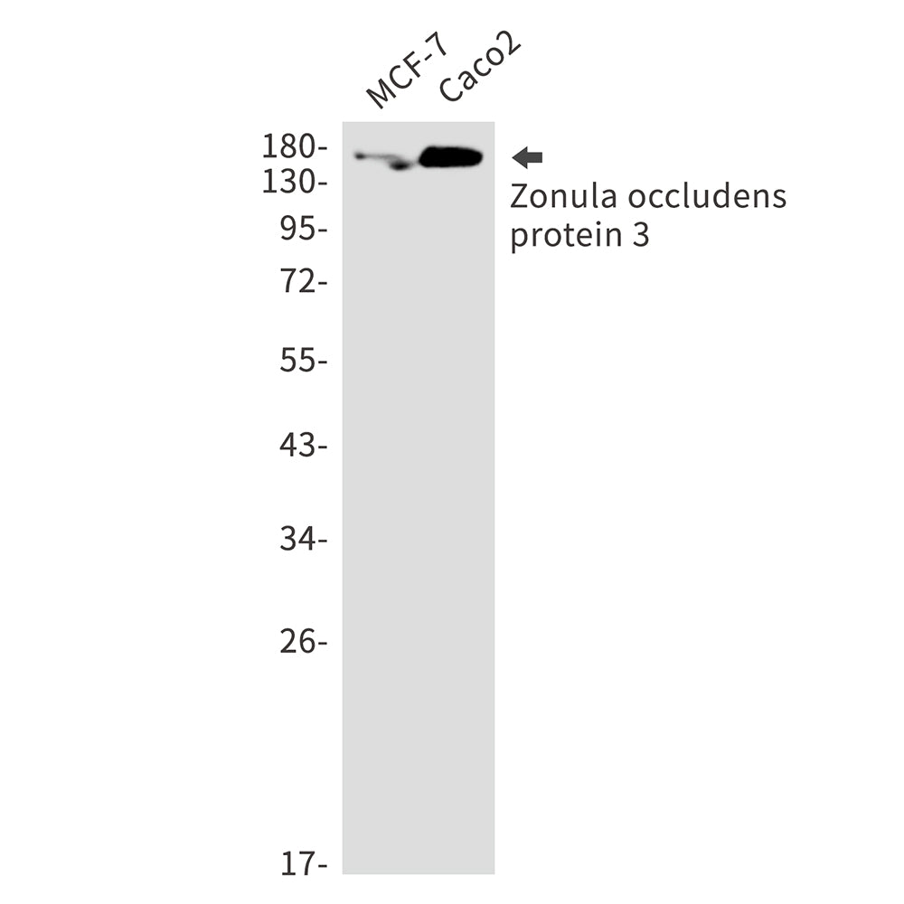 Tight Junction Protein ZO 3 Rabbit Monoclonal Antibody