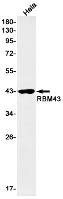 RBM43 Rabbit Monoclonal Antibody