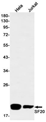 SF20 Rabbit Monoclonal Antibody