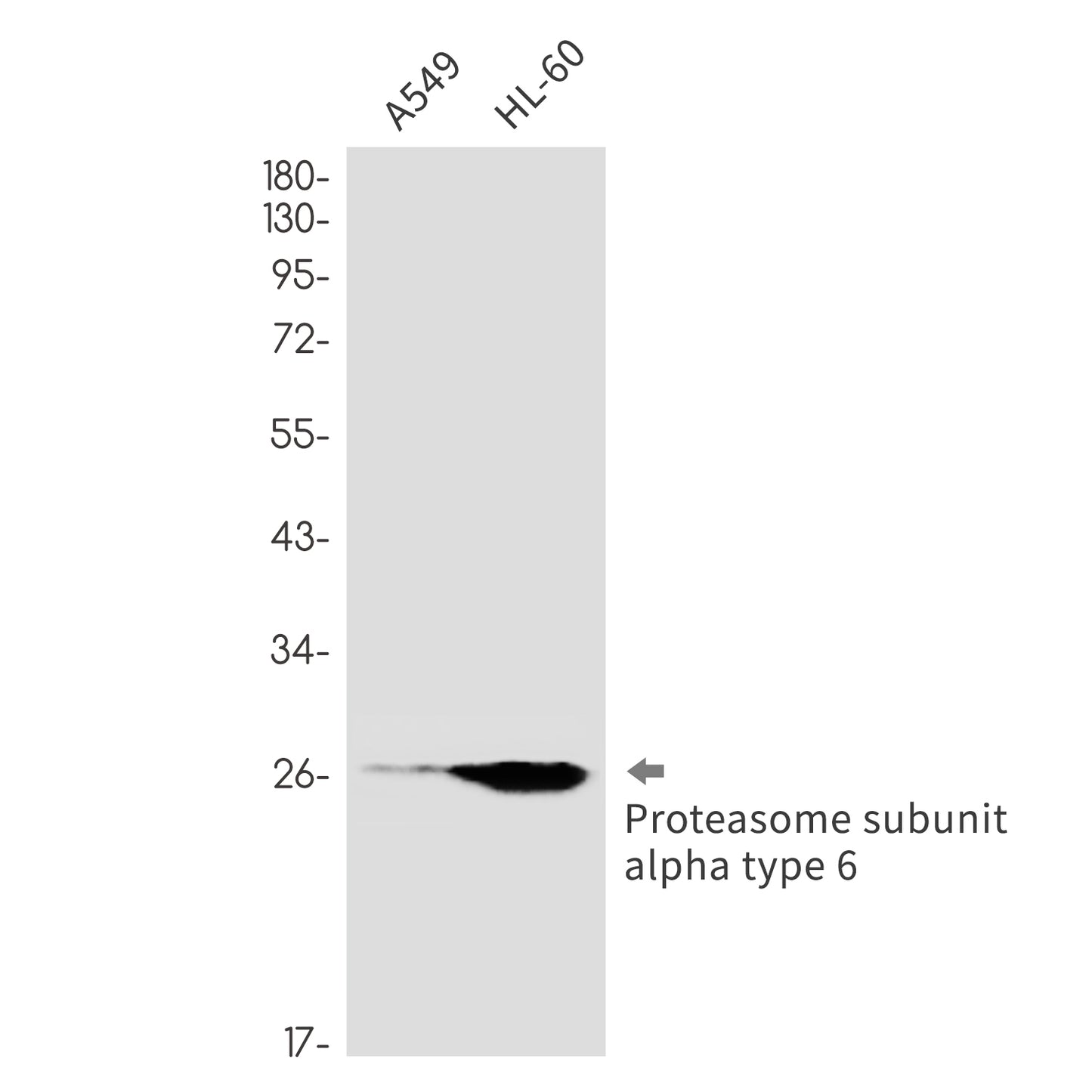 Proteasome alpha 6 Rabbit Monoclonal Antibody