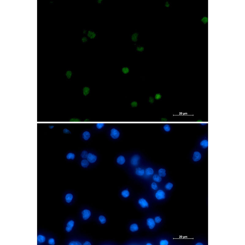 RNA Polymerase II Subunit B1 Rabbit Monoclonal Antibody