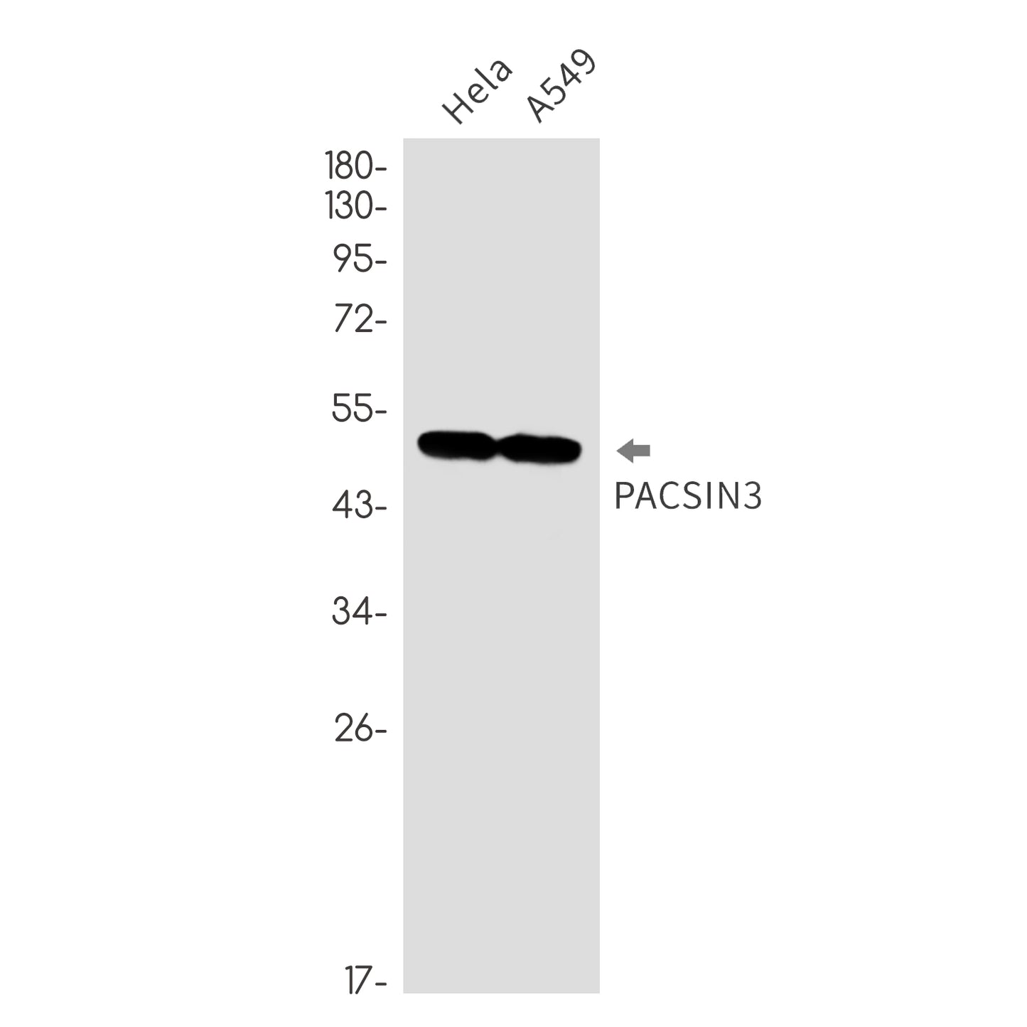 PACSIN3 Rabbit Monoclonal Antibody