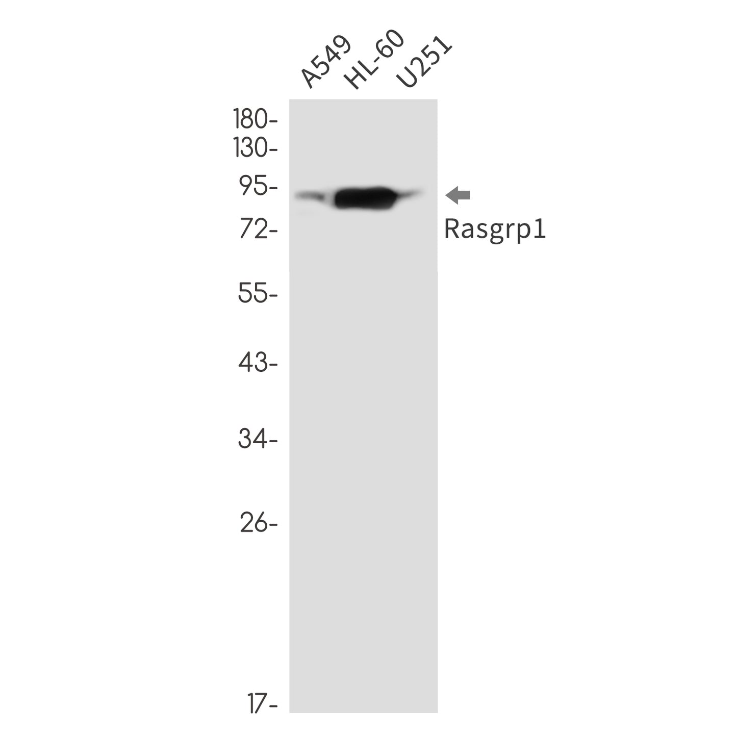 RASGRP1 Rabbit Monoclonal Antibody