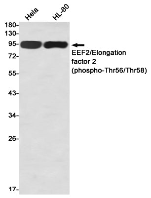Phospho-Elongation Factor 2 (Thr56/Thr58) Rabbit Monoclonal Antibody
