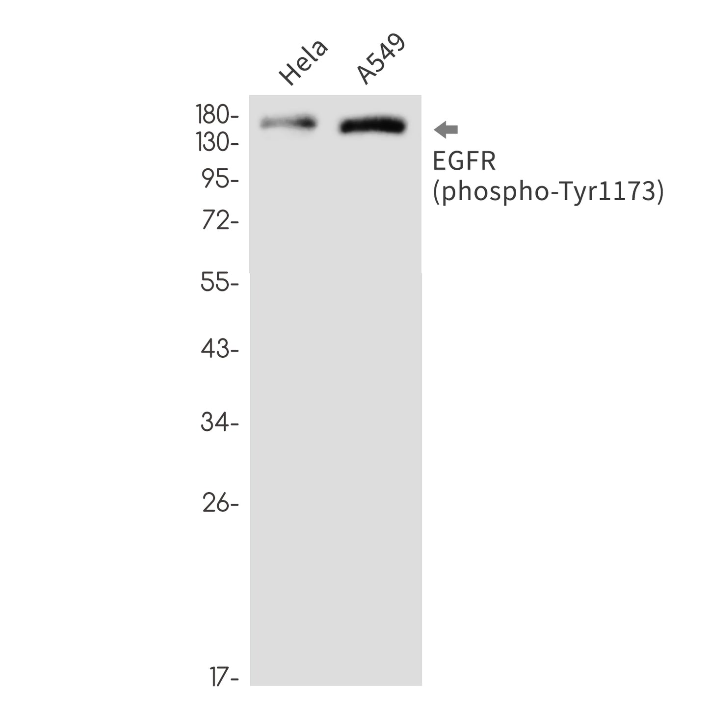 Phospho-EGFR (Tyr1173) Rabbit Monoclonal Antibody