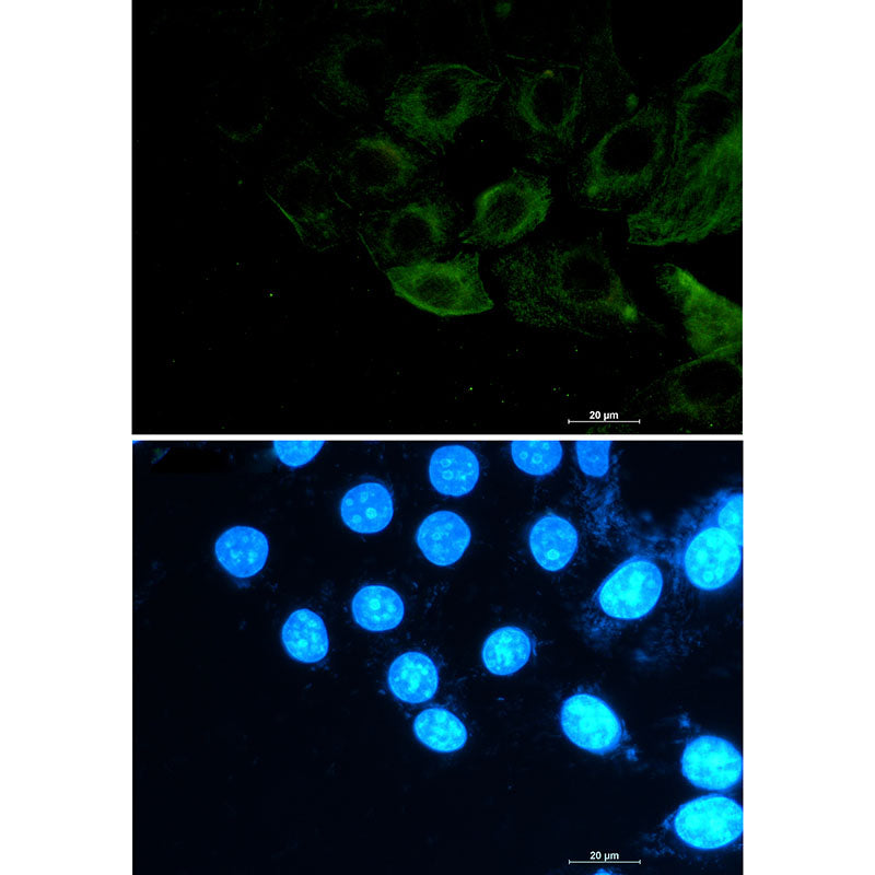 Phospho-Filamin A/B (Ser2152/Ser2107) Rabbit Monoclonal Antibody