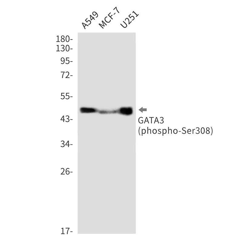 Phospho-GATA3 (Ser308) Rabbit Monoclonal Antibody