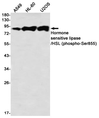 Phospho-Hormone Sensitive Lipase (Ser855) Rabbit Monoclonal Antibody