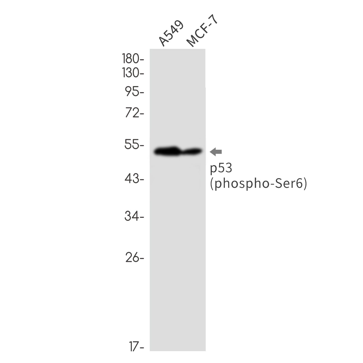 Phospho-p53 (Ser6) Rabbit Monoclonal Antibody