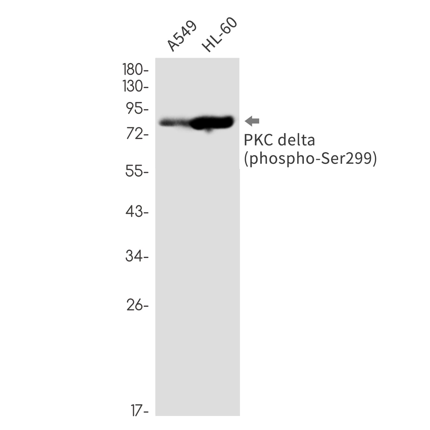 Phospho-PKC delta (Ser299) Rabbit Monoclonal Antibody