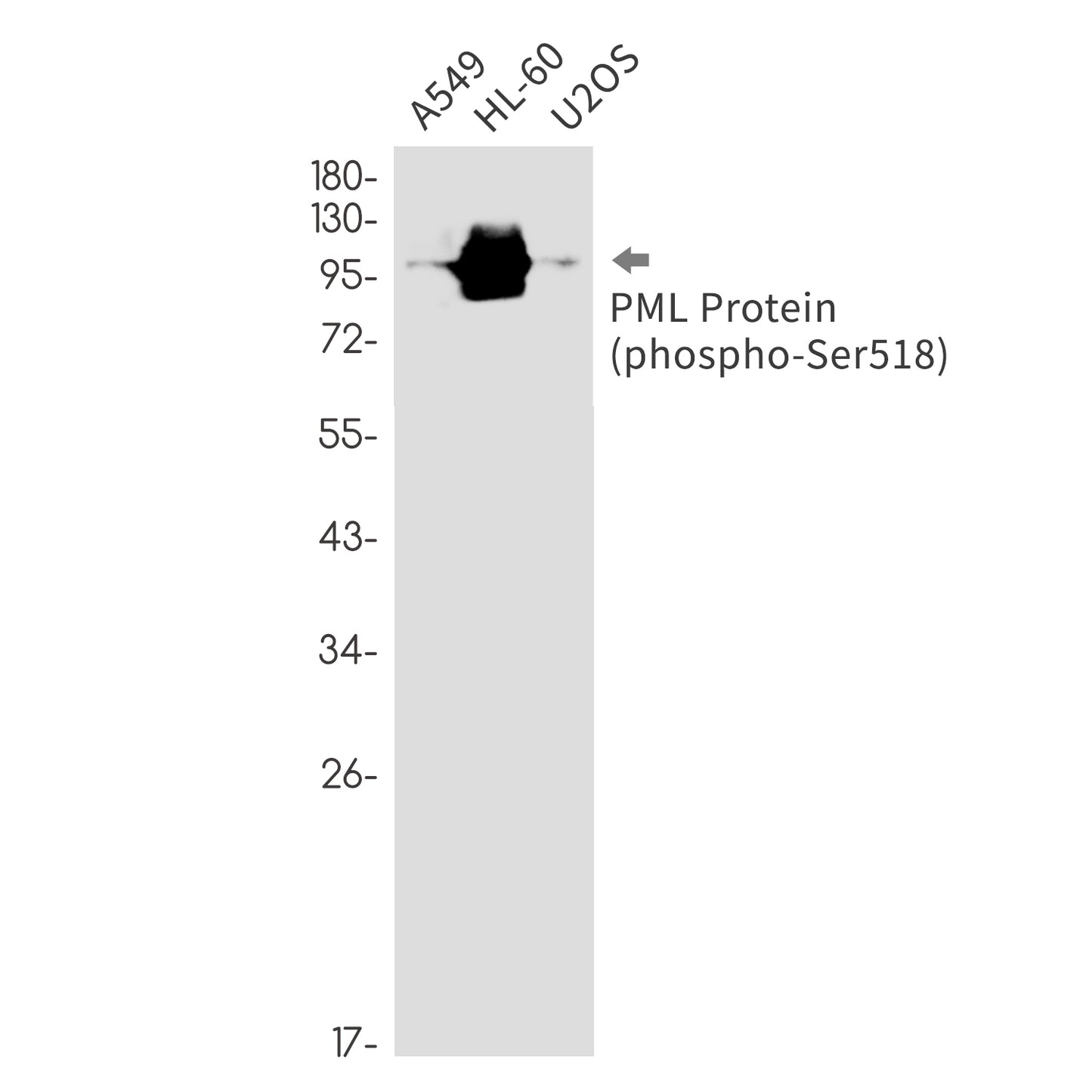Phospho-PML Protein (Ser518) Rabbit Monoclonal Antibody