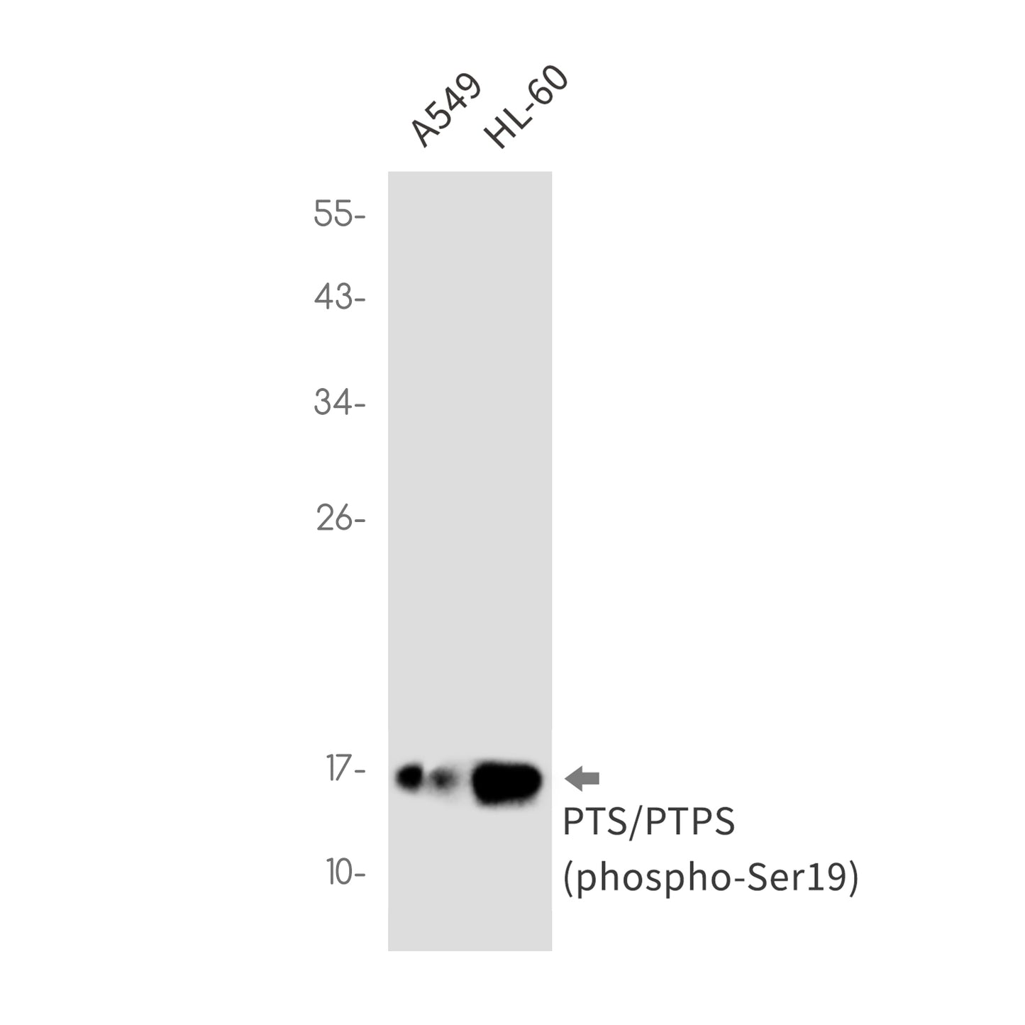 Phospho-PTS (Ser19) Rabbit Monoclonal Antibody