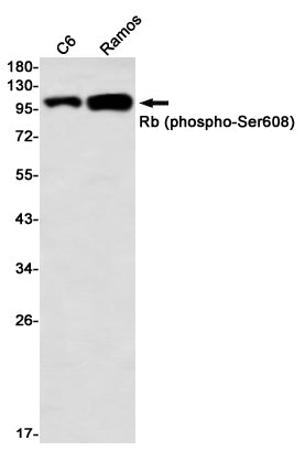 Phospho-Rb (Ser608) Rabbit Monoclonal Antibody