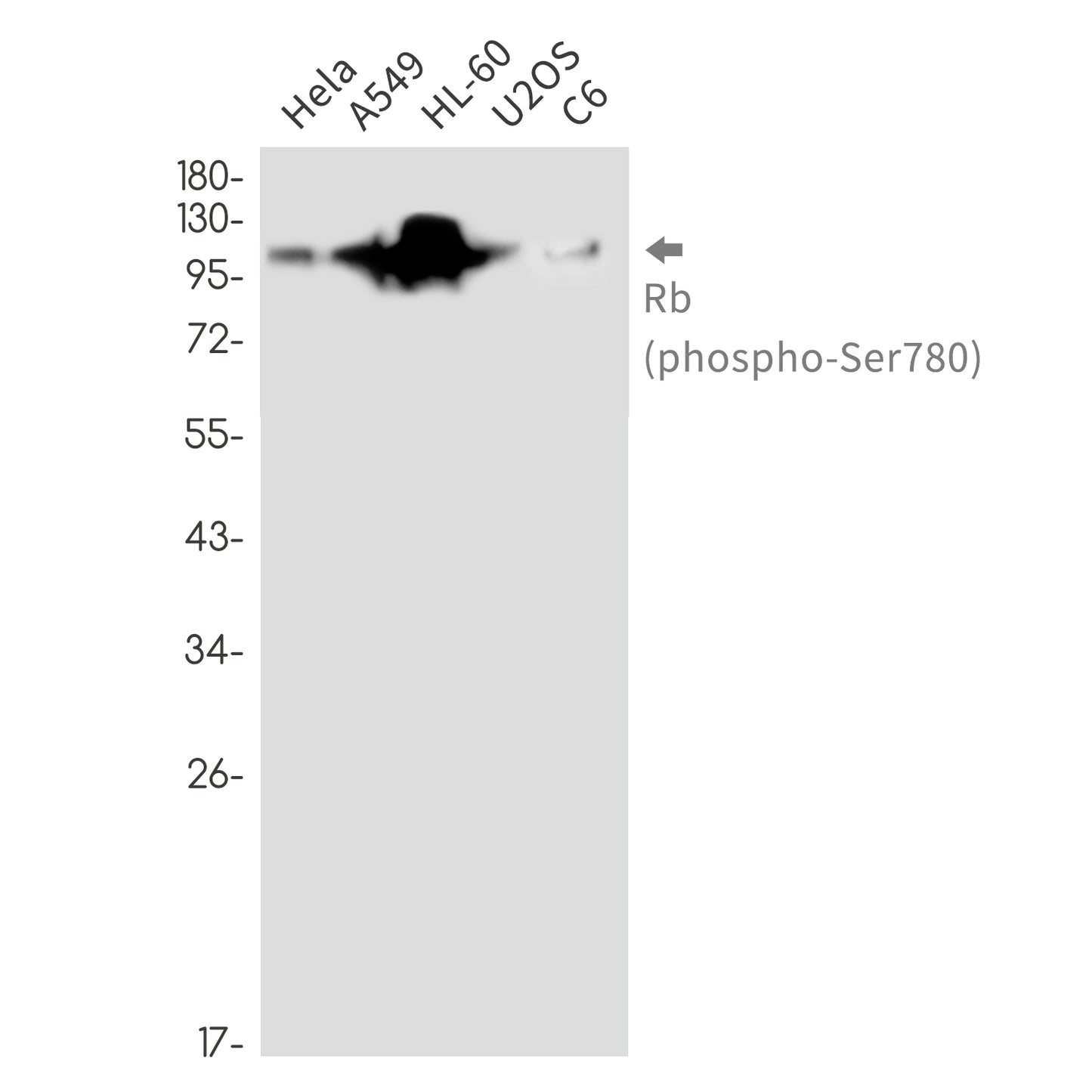 Phospho-Rb (Ser780) Rabbit Monoclonal Antibody