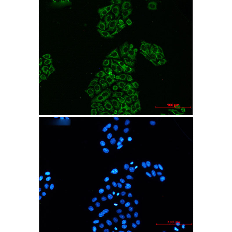 AK2 Rabbit Monoclonal Antibody