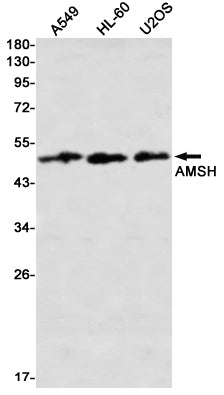 AMSH Rabbit Monoclonal Antibody