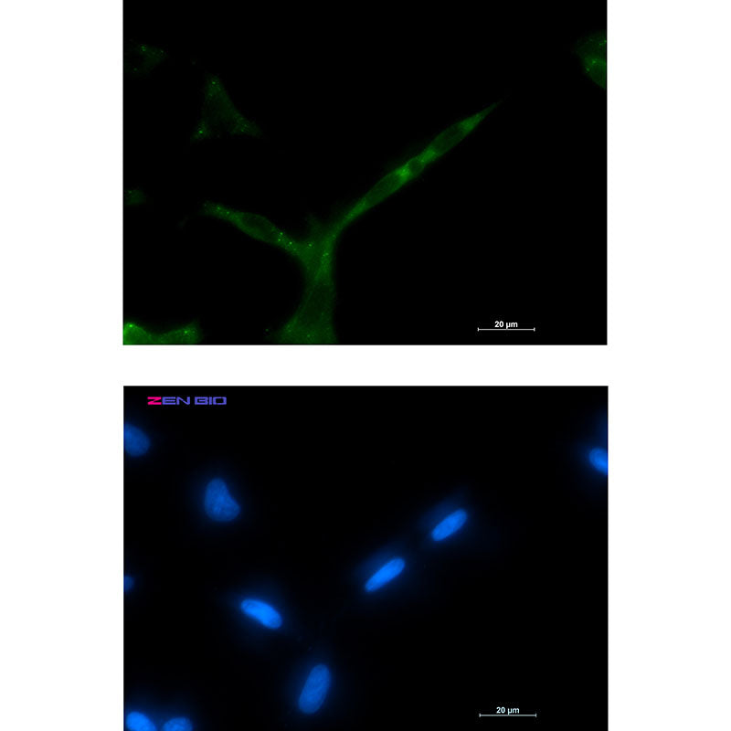 APC Rabbit Monoclonal Antibody
