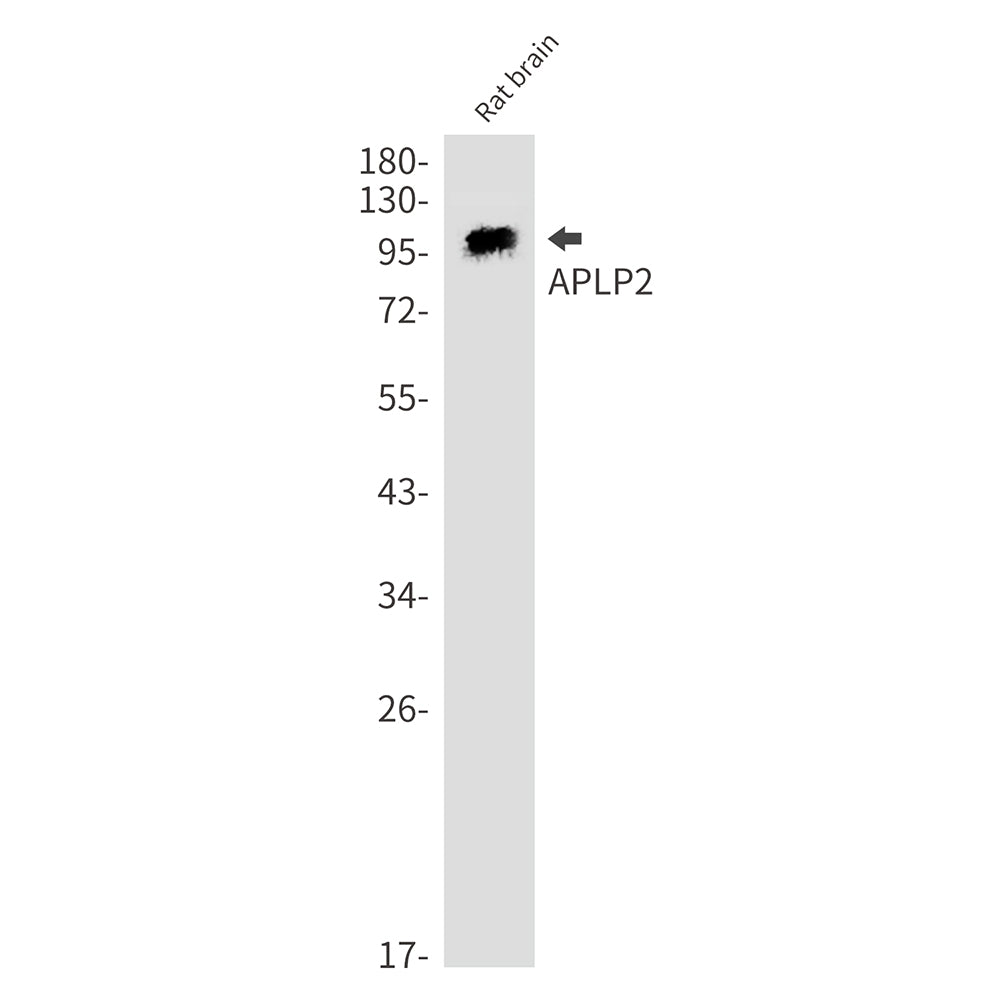 APLP2 Rabbit Monoclonal Antibody