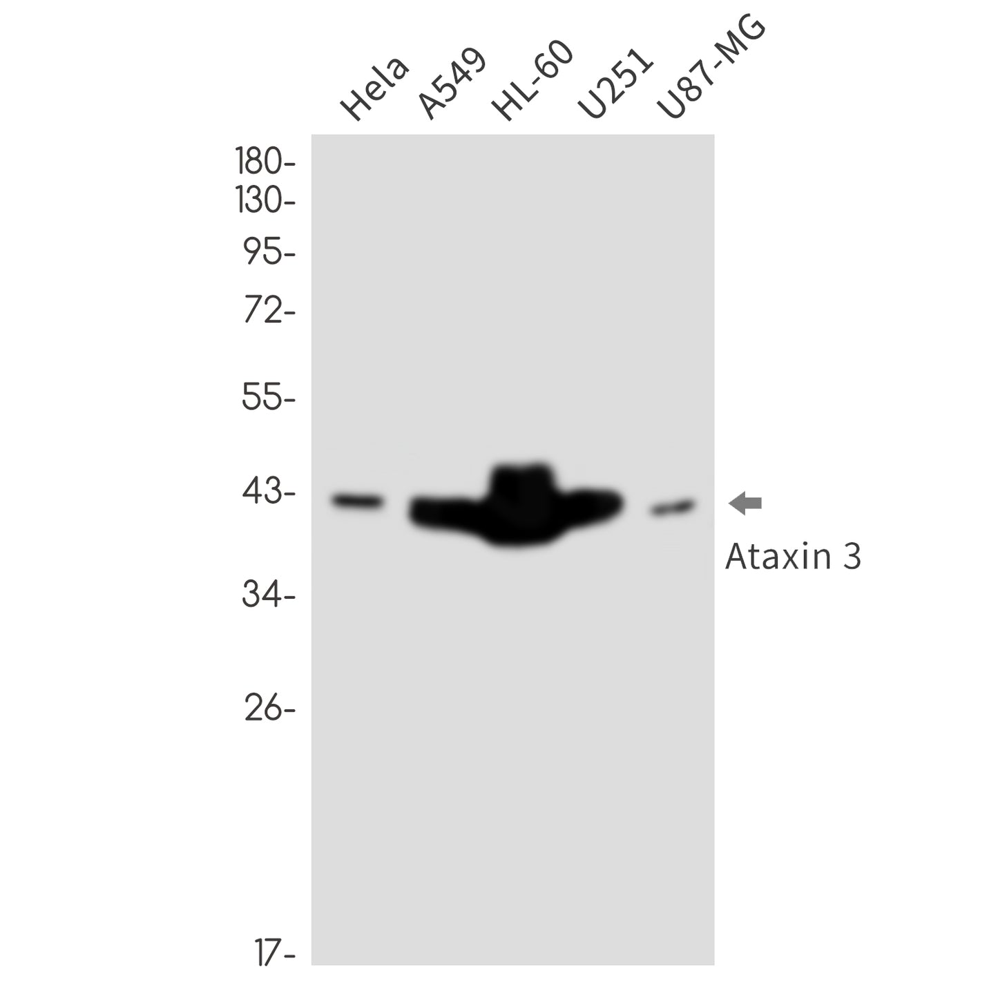 Ataxin 3 Rabbit Monoclonal Antibody