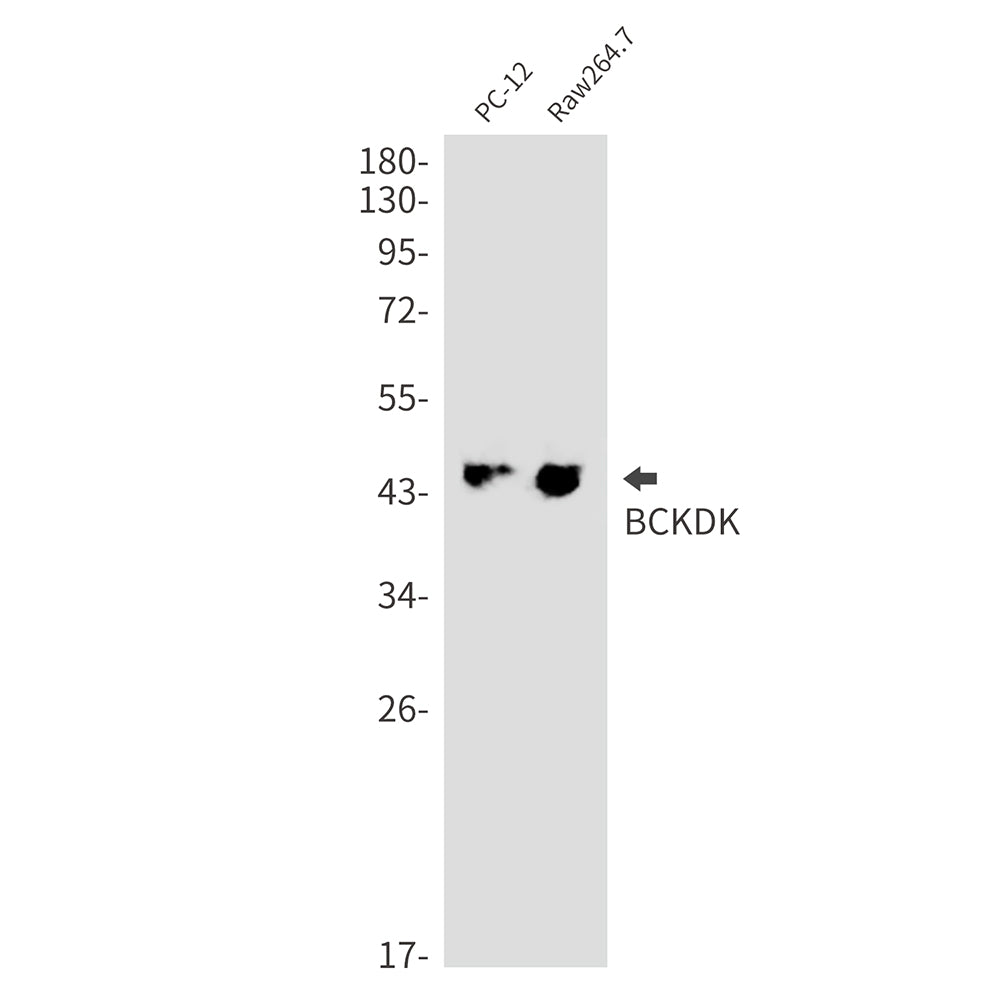 BCKDK Rabbit Monoclonal Antibody