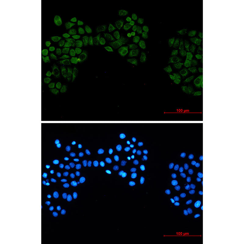 Casein Kinase 2 beta Rabbit Monoclonal Antibody