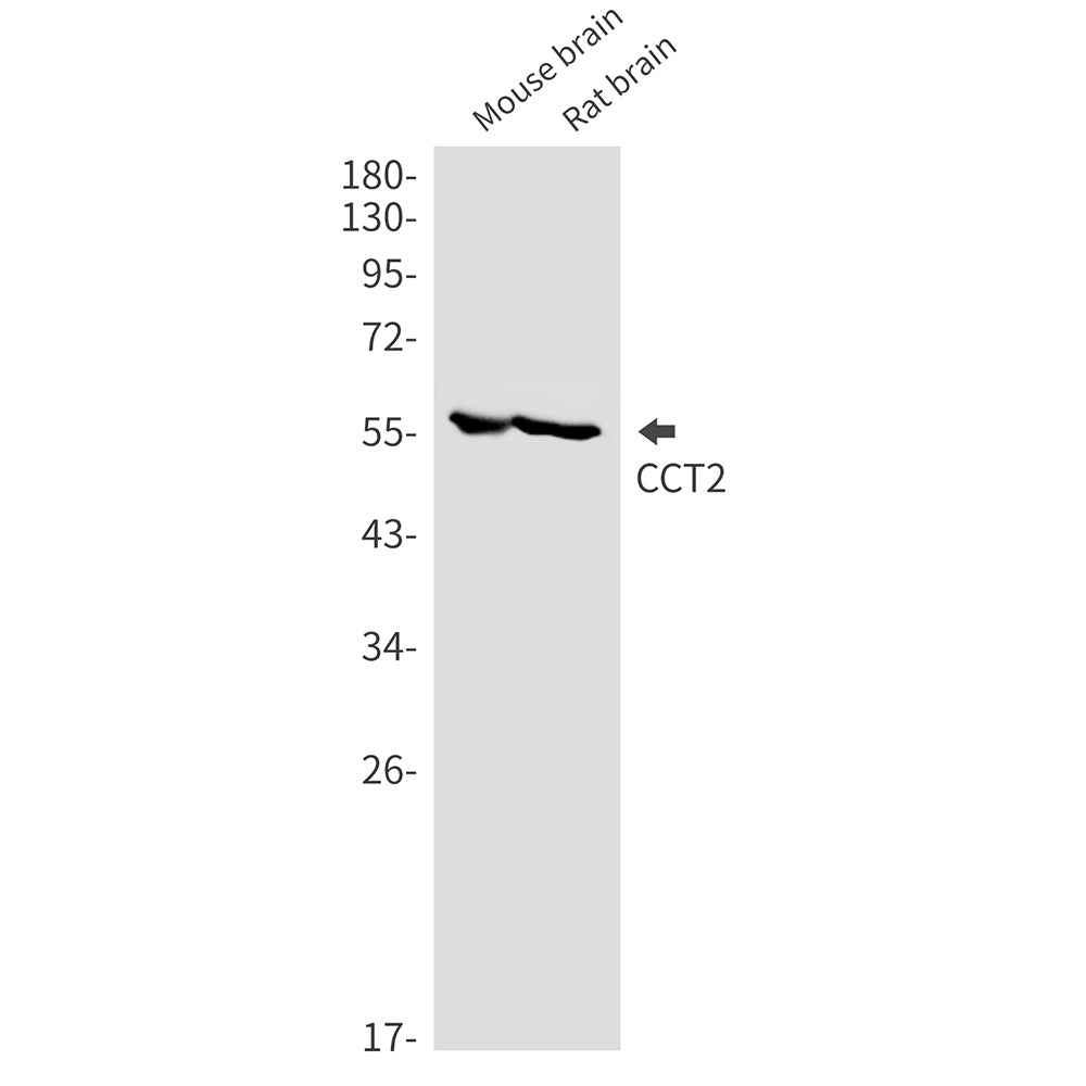 CCT2 Rabbit Monoclonal Antibody