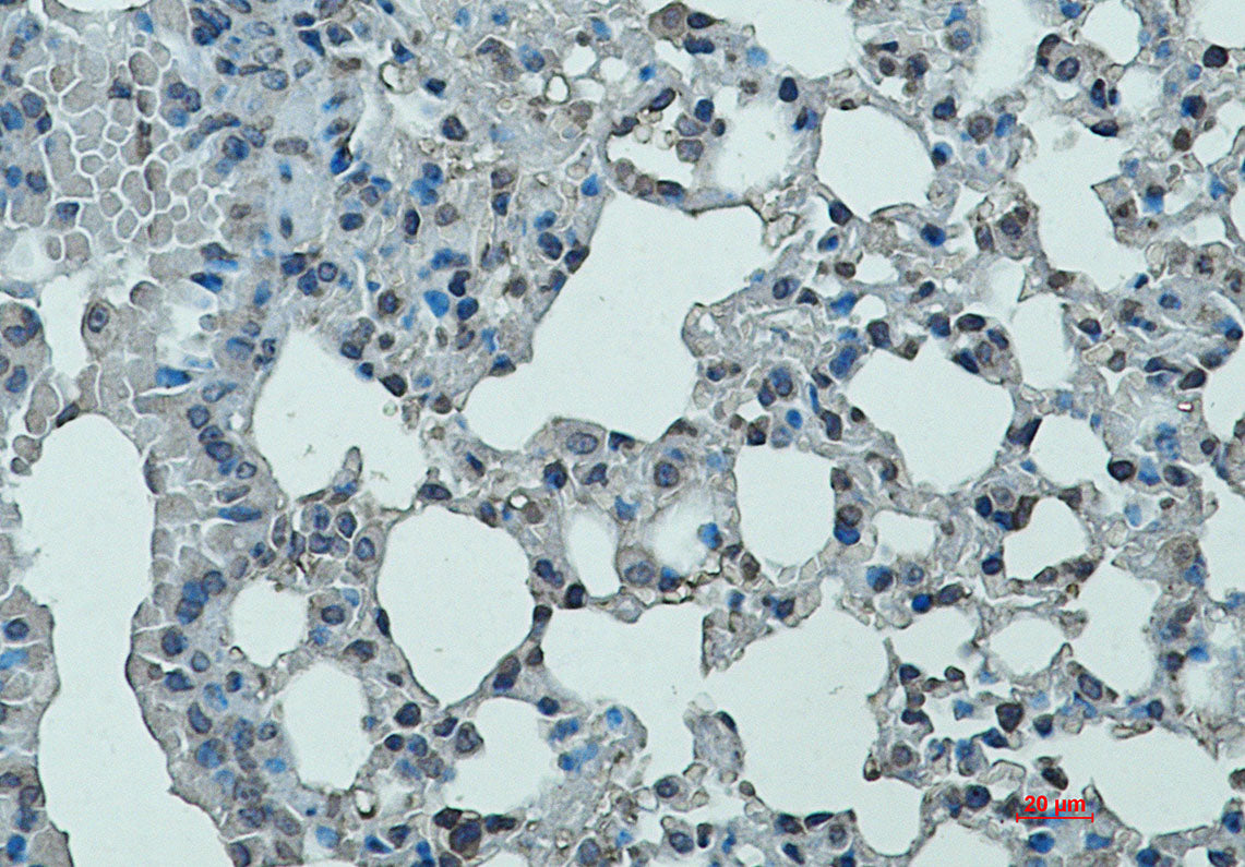 Integrin alpha L Rabbit Monoclonal Antibody