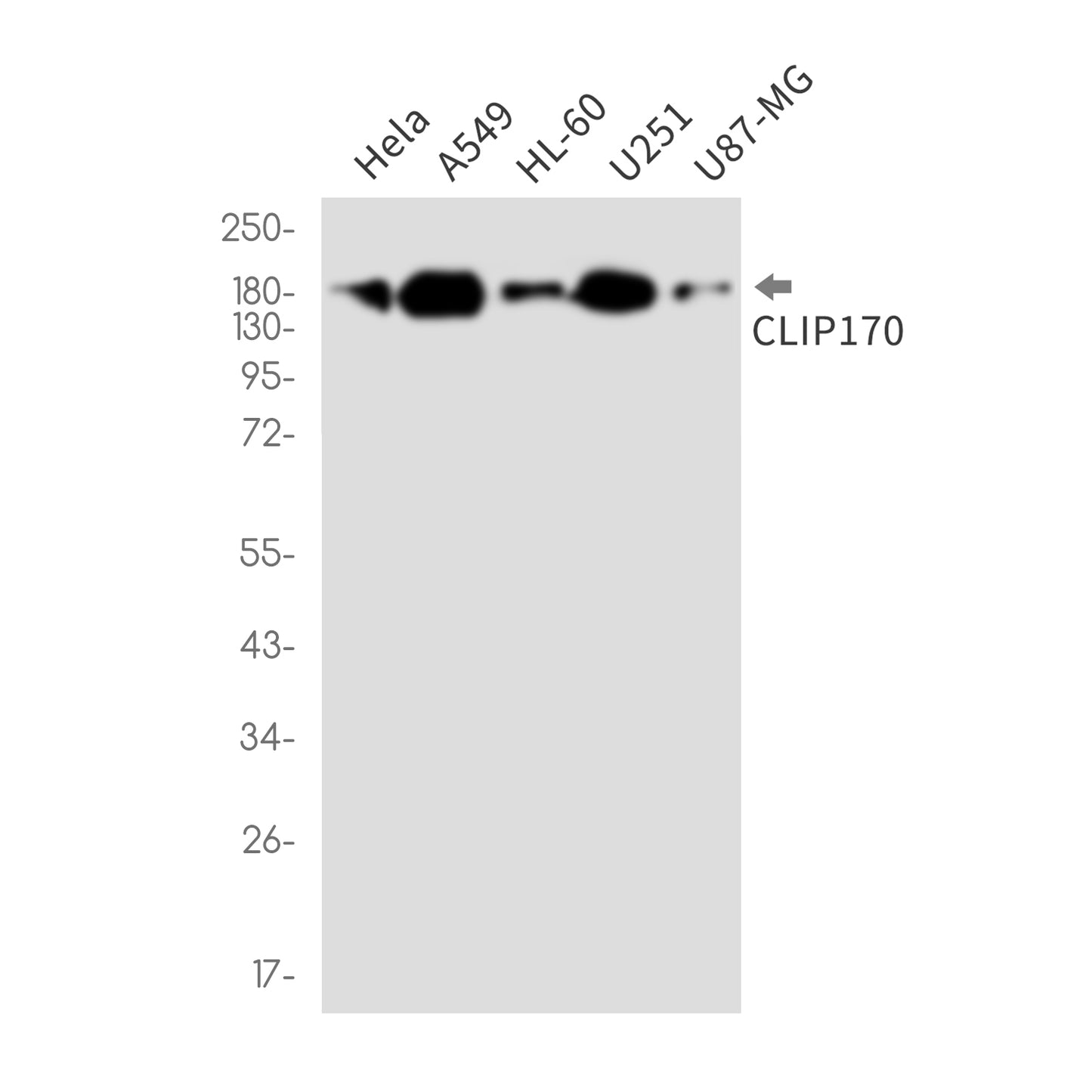 CLIP170 Rabbit Monoclonal Antibody