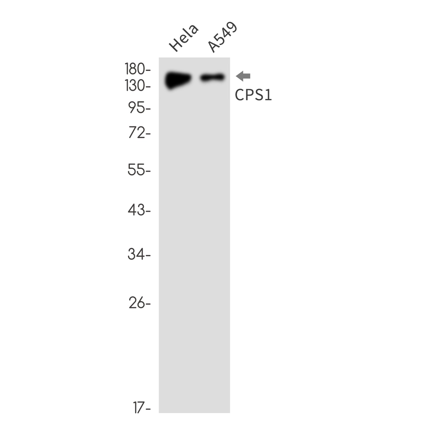 CPS1 Rabbit Monoclonal Antibody