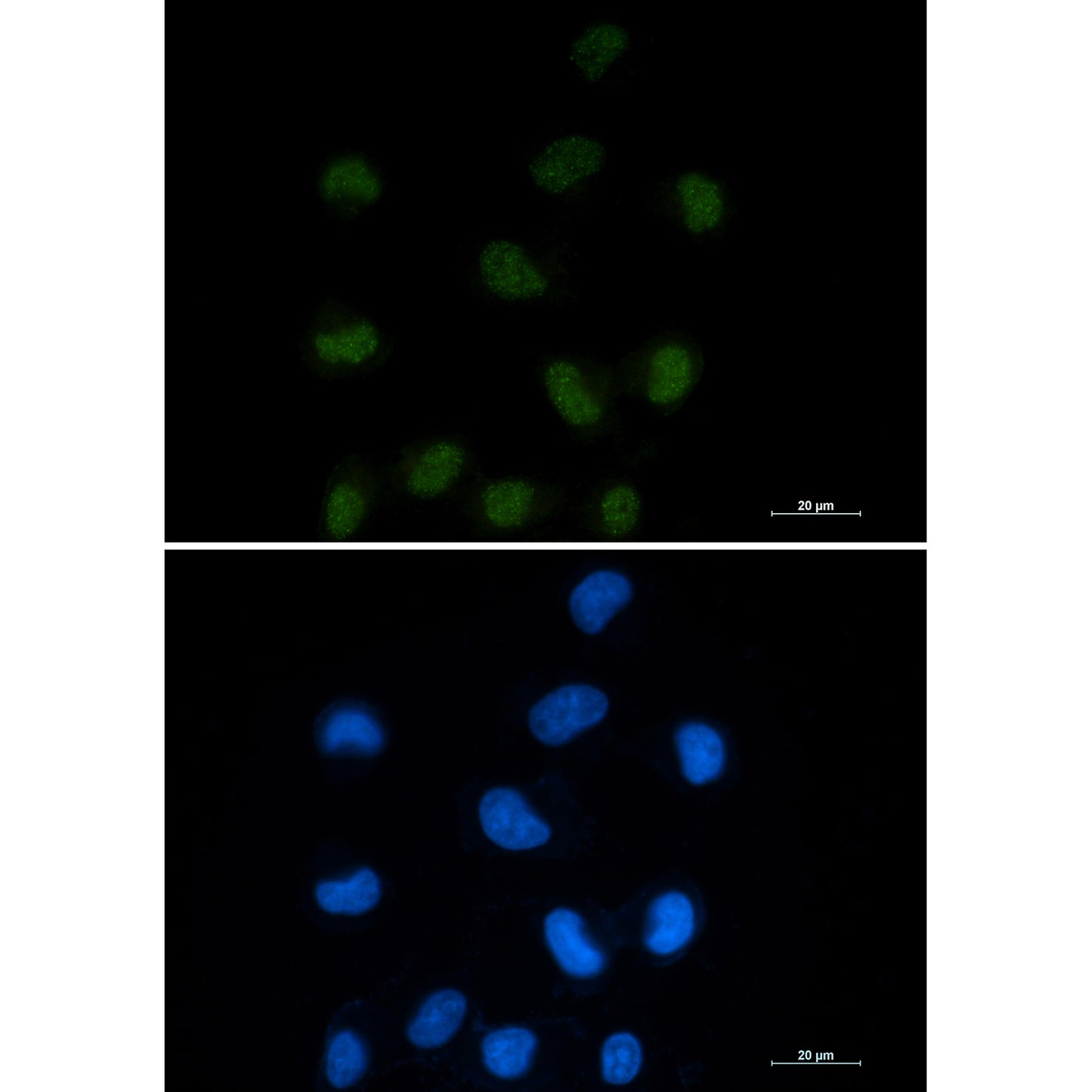 CTBP1 Rabbit Monoclonal Antibody