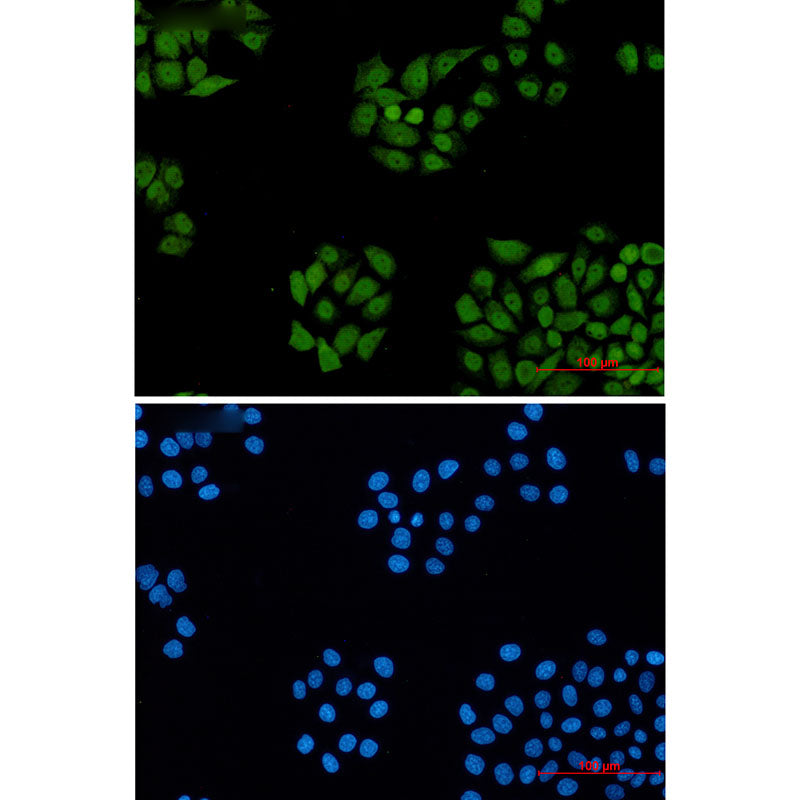 DDB1 Rabbit Monoclonal Antibody