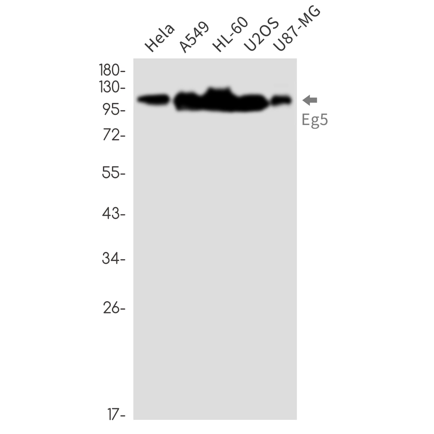 Eg5 Rabbit Monoclonal Antibody