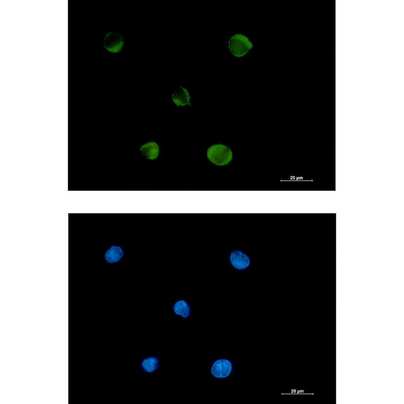 FADS1 Rabbit Monoclonal Antibody
