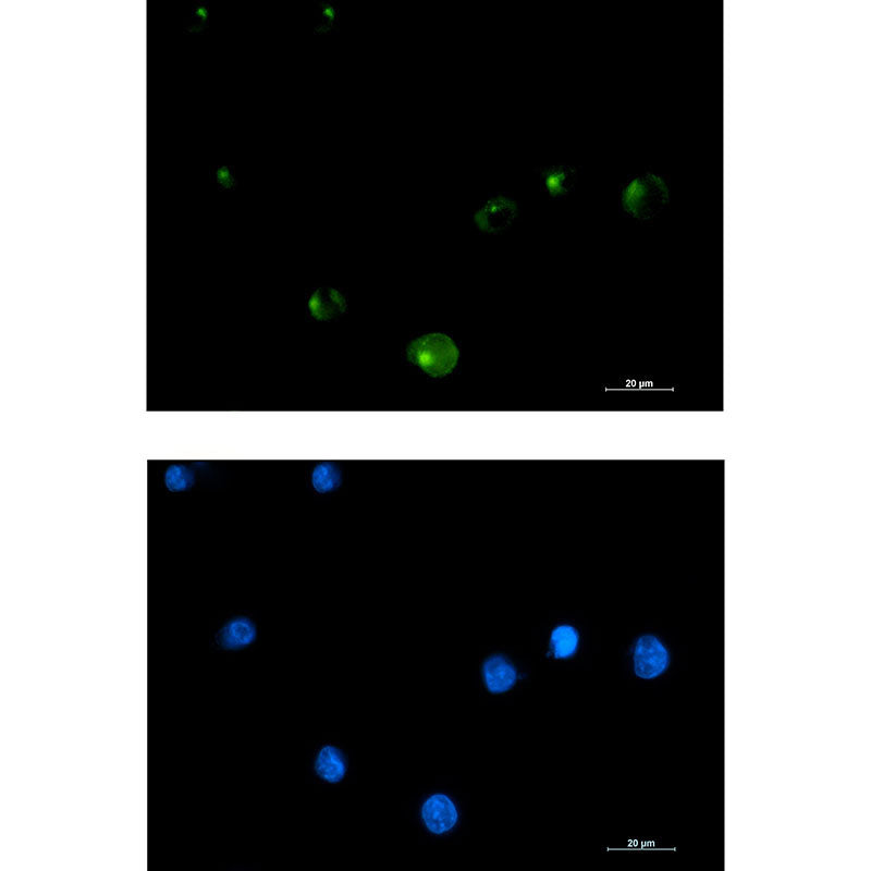 FGFR1 Oncogene Partner Rabbit Monoclonal Antibody