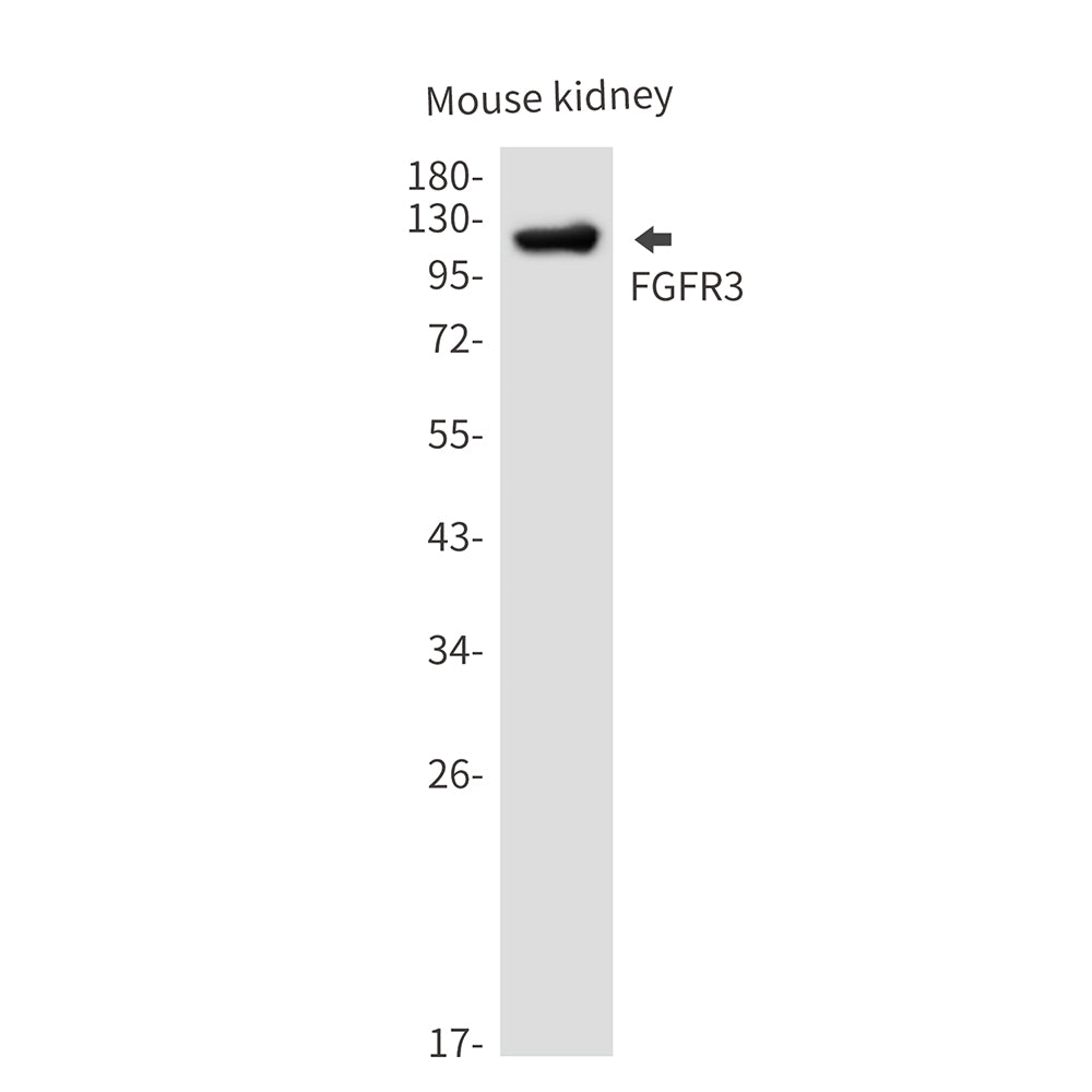 FGFR3 Rabbit Monoclonal Antibody